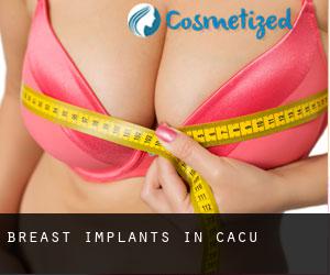 Breast Implants in Caçu