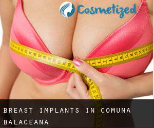 Breast Implants in Comuna Bălăceana
