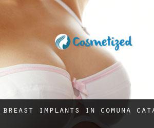 Breast Implants in Comuna Caţa