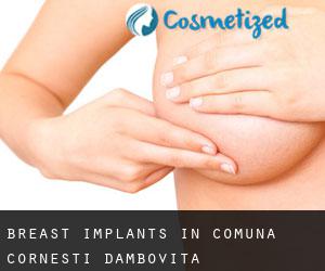 Breast Implants in Comuna Corneşti (Dâmboviţa)