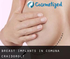 Breast Implants in Comuna Craidorolţ