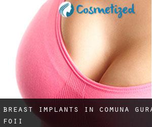 Breast Implants in Comuna Gura Foii