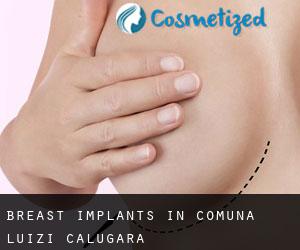 Breast Implants in Comuna Luizi-Cãlugãra