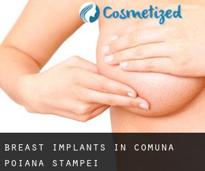 Breast Implants in Comuna Poiana Stampei