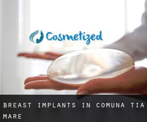 Breast Implants in Comuna Tia Mare