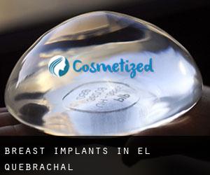 Breast Implants in El Quebrachal