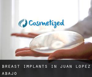 Breast Implants in Juan López Abajo