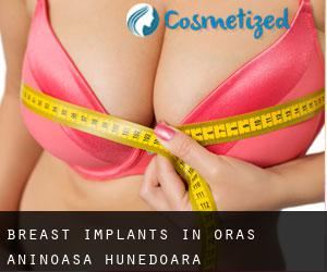 Breast Implants in Oraş Aninoasa (Hunedoara)