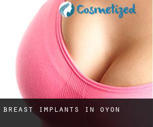 Breast Implants in Oyon