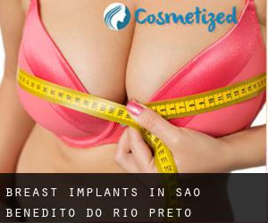 Breast Implants in São Benedito do Rio Preto