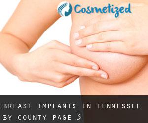 Breast Implants in Tennessee by County - page 3