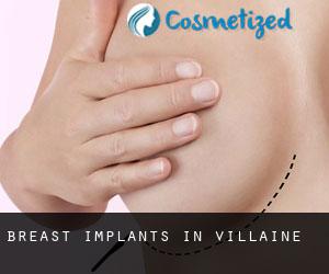 Breast Implants in Villaine