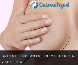 Breast Implants in Villarreal / Vila-real