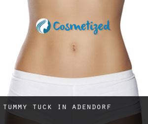 Tummy Tuck in Adendorf