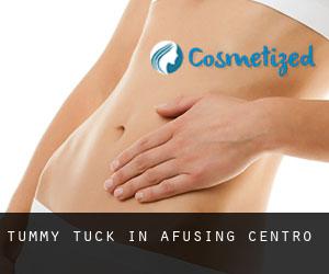 Tummy Tuck in Afusing Centro