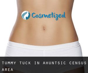 Tummy Tuck in Ahuntsic (census area)