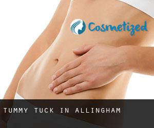 Tummy Tuck in Allingham Tummy Tuck in Allingham
