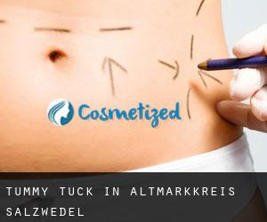 Tummy Tuck in Altmarkkreis Salzwedel