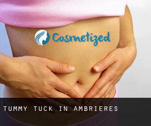 Tummy Tuck in Ambrières