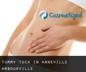 Tummy Tuck in Anneville-Ambourville
