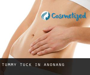 Tummy Tuck in Anonang