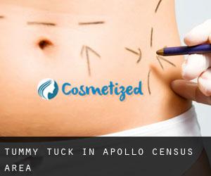 Tummy Tuck in Apollo (census area)