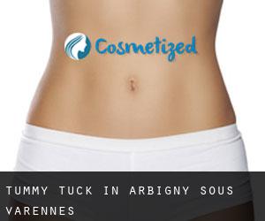 Tummy Tuck in Arbigny-sous-Varennes