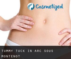 Tummy Tuck in Arc-sous-Montenot