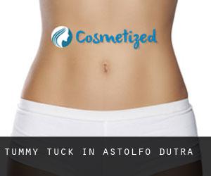 Tummy Tuck in Astolfo Dutra