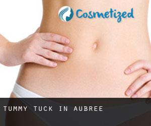 Tummy Tuck in Aubrée