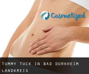 Tummy Tuck in Bad Dürkheim Landkreis