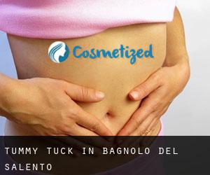 Tummy Tuck in Bagnolo del Salento