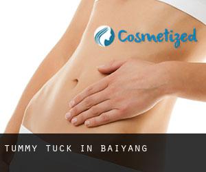 Tummy Tuck in Baiyang