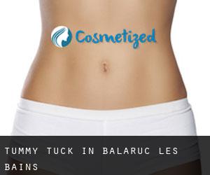 Tummy Tuck in Balaruc-les-Bains