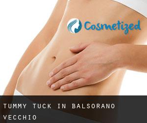 Tummy Tuck in Balsorano Vecchio