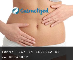 Tummy Tuck in Becilla de Valderaduey