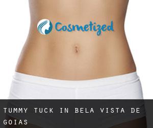 Tummy Tuck in Bela Vista de Goiás