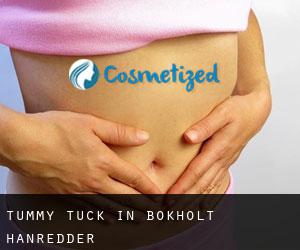Tummy Tuck in Bokholt-Hanredder