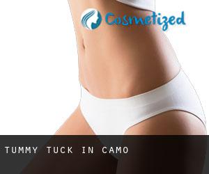 Tummy Tuck in Camo