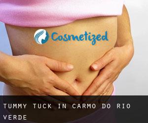 Tummy Tuck in Carmo do Rio Verde