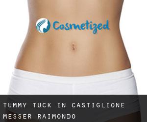 Tummy Tuck in Castiglione Messer Raimondo