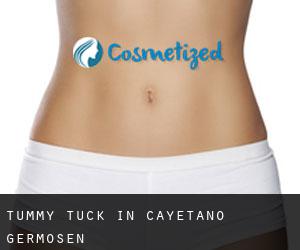 Tummy Tuck in Cayetano Germosén