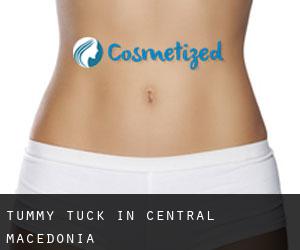 Tummy Tuck in Central Macedonia
