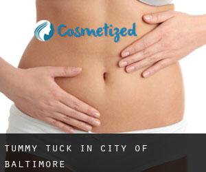 Tummy Tuck in City of Baltimore