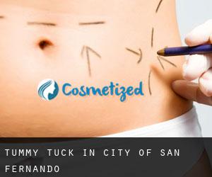 Tummy Tuck in City of San Fernando