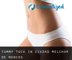 Tummy Tuck in Ciudad Melchor de Mencos