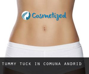 Tummy Tuck in Comuna Andrid