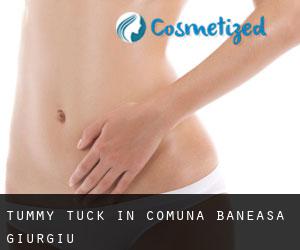 Tummy Tuck in Comuna Băneasa (Giurgiu)