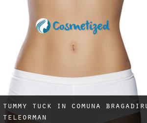 Tummy Tuck in Comuna Bragadiru (Teleorman)