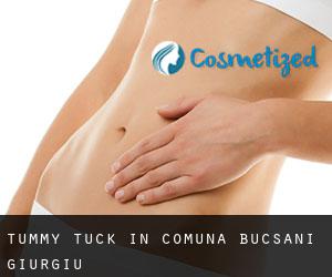 Tummy Tuck in Comuna Bucşani (Giurgiu)